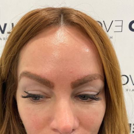 Before and after eyebrow restoration showcasing natural, full eyebrows with expert eyebrow